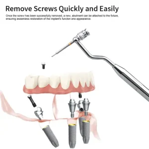 1 Set Dental Implant Removal Kit Damaged Screw Extractor Set Universal Implant Prosthetic Kits For Clinic Bangladesh (New)